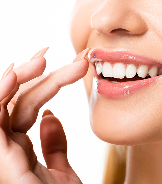 What are E-Max Veneers - Thousand Smiles Dental Clinic